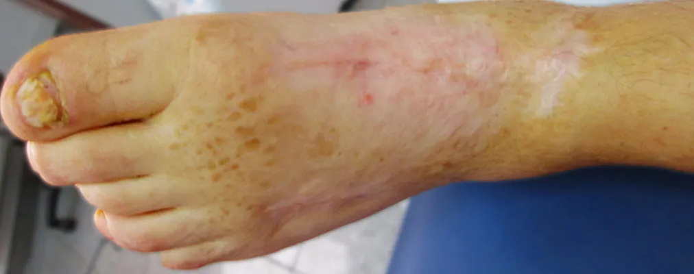 blog-post-image