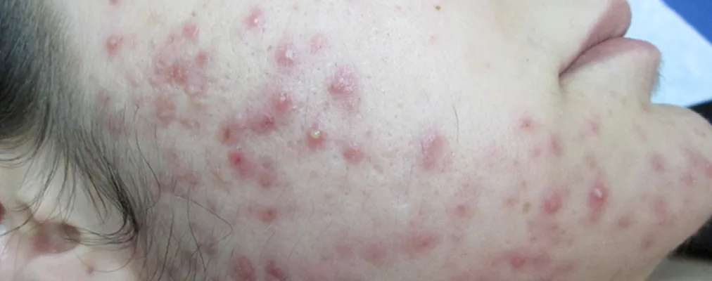 blog-post-image